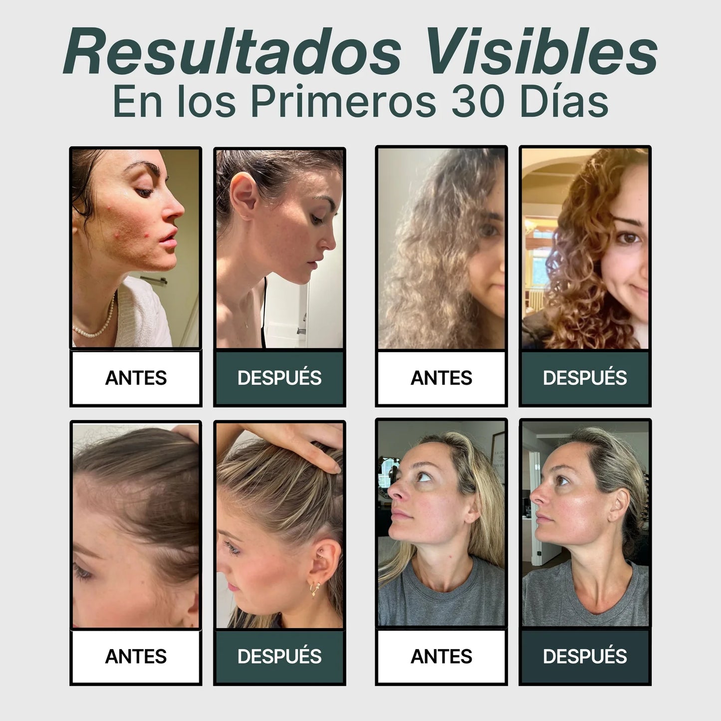 Salva Tu Piel, Tu Pelo y Tu Salud del Desastre con Hera™